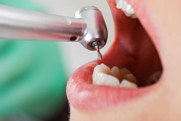 Best Emergency Treatment for Jaw Pain or Injury in Mansfield, LA